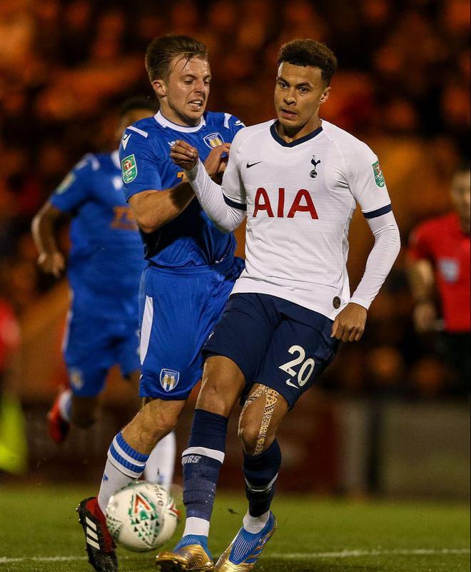 意媒：佩莱格里尼在训练中疑似肌肉受伤，若确诊将伤缺数周（意媒：佩莱格里尼训练时疑似肌肉受伤，确诊或将缺阵数周）